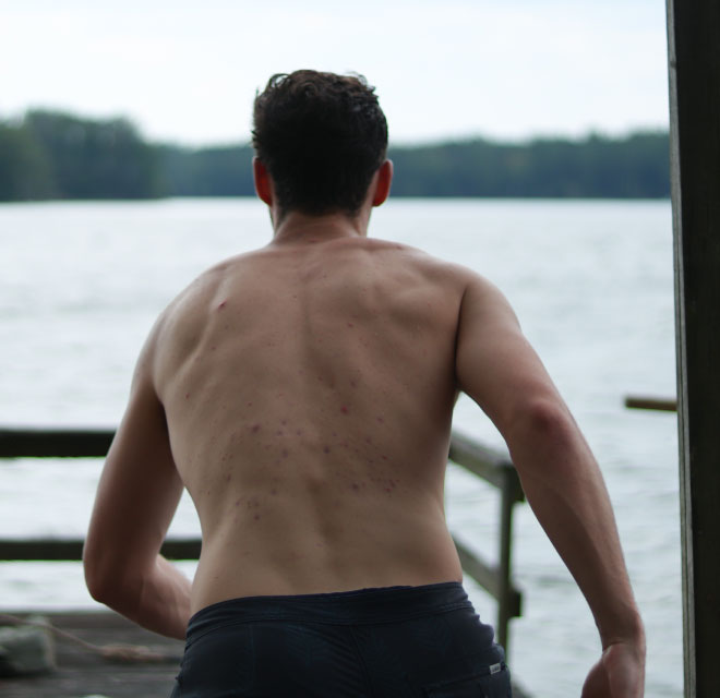 Man preparing to jump into a lake, Chiropractic Treatment in Montana
