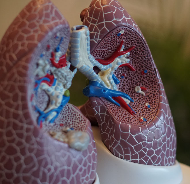 Plastic Model of human lungs, Pulmonology in Montana